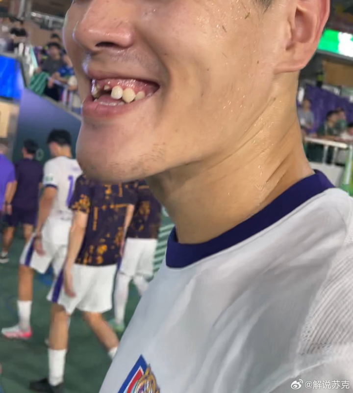 开云网站-津门虎0-2负浙江遭遇失利，中卫王献钧拼抢中门牙遭撞击脱落